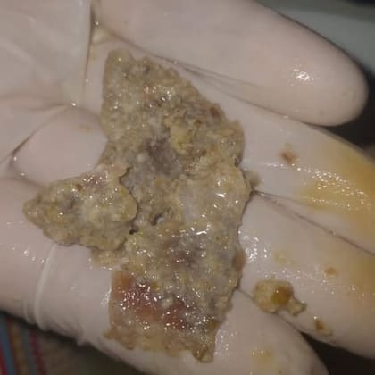 “Alarma en Frías”: vecinos advierten sobre milanesas de dudosa procedencia