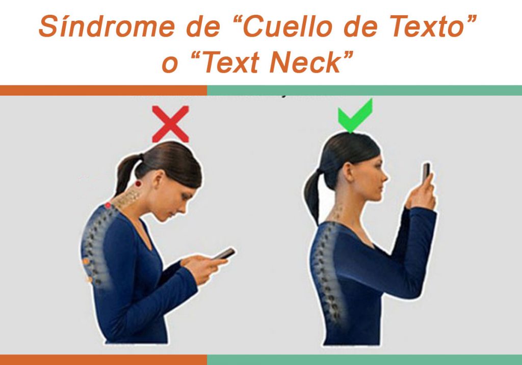 Qué es el síndrome del cuello de texto y por qué preocupa a los médicos