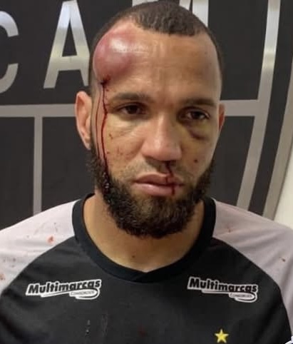 ¡¡INSÓLITO!! Portero del Atlético Mineiro brutalmente agredido tras la batalla campal con Cruzeiro